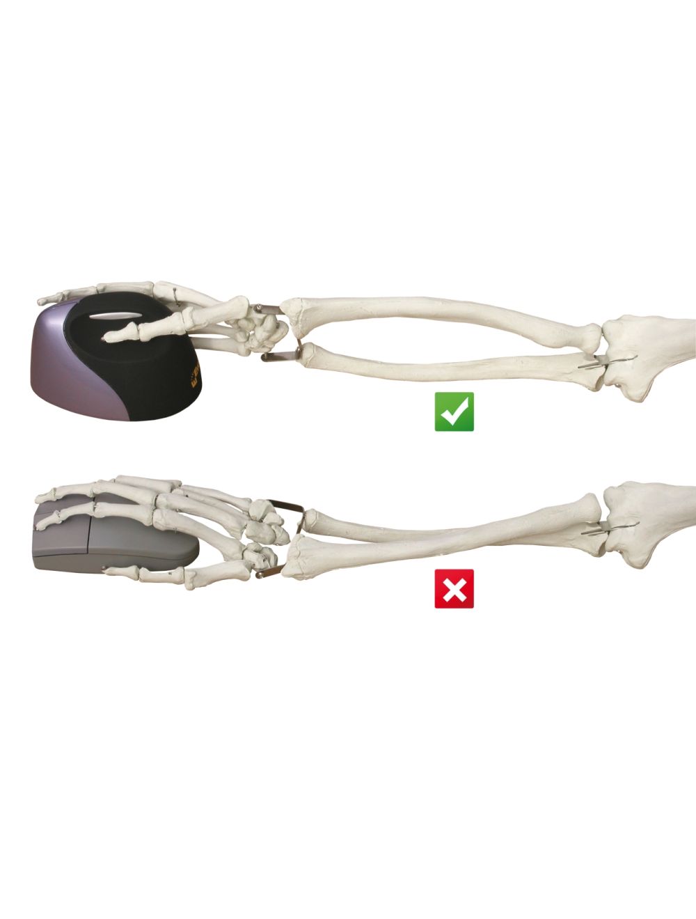 Effect of verticality on hand motion - Ulnar deviation
